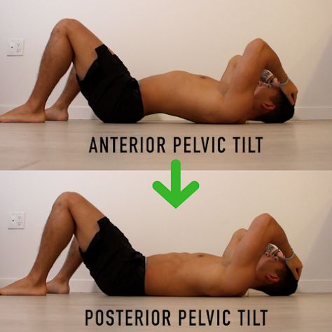 How I Fixed my Anterior Pelvic Tilt (APT) - Ronald Leite - Medium Fix Anterior Pelvic Tilt, Anterior Pelvic Tilt, Posture Correction Exercises, Beginner Exercises, Stability Exercises, Sciatica Exercises, Lower Back Pain Exercises, Pelvic Tilt, Posture Exercises