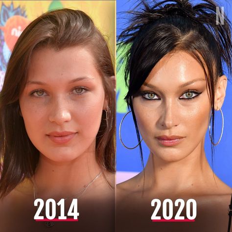 Nicki Swift on Instagram: “Happy 24th birthday to Bella Hadid! 🎈🎂 In honor of her birthday, check out this incredible 6 year transformation!” Bella Hadid Vitamins, Bella Hadid Surgery, Bella Hadid Old Pictures, Bella Hadid Before And After Surgery, Happy 24th Birthday, Bella Hadid News, Cosmetic Injectables, Almond Shaped Eyes, Bella Hair