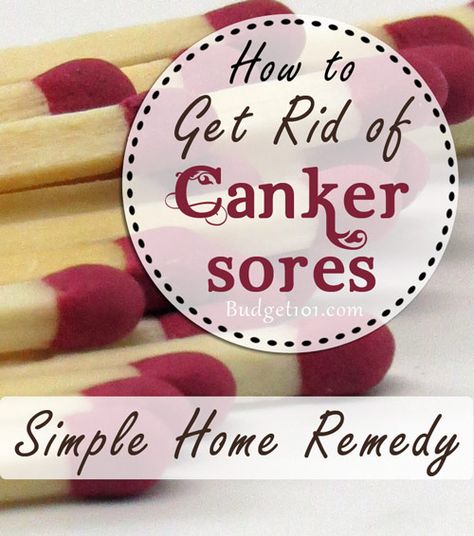 Homemade Canker Sore Remedy Snoring Remedies, Canker Sore, Homemade Remedies, Diy Health, Back To Nature, Natural Home Remedies, Health And Beauty Tips, Natural Medicine, Home Health