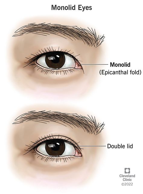 Monolid Eyes: Epicanthal Folds & Causes Epicanthic Fold, Eyes Reference, Monolid Eyes, How To Use Makeup, How To Draw Eyes, Droopy Eyelids, Fetal Alcohol, Draw Eyes, Upper Eyelid