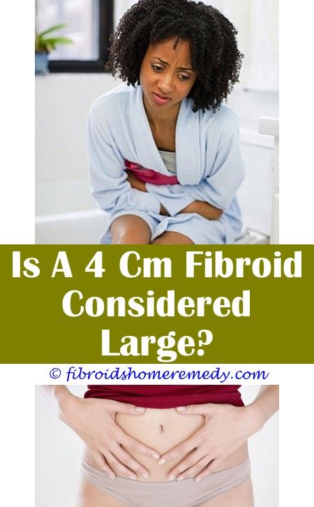 Fibroid Sizes Chart: A Visual Reference of Charts | Chart Master