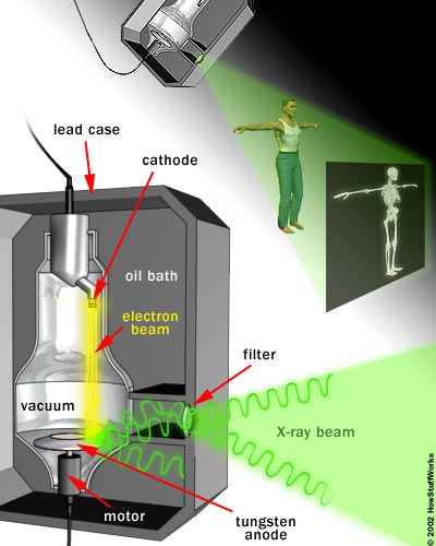 HowStuffWorks "How X-rays Work" X Ray Tube Diagram, Xray Illustration, Xray School, X Ray Machine, Rad Tech Student, Tesla Technology, Radiology Student, Physics Memes, Radiology Tech