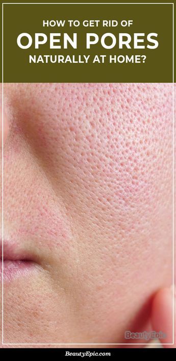 Minimize Pores Naturally, Skin Care For Oily Skin, Big Pores, Face Mask For Pores, Best Anti Aging Skin Care, Face Pores, Beauty Hacks Skincare, Smaller Pores, Open Pores