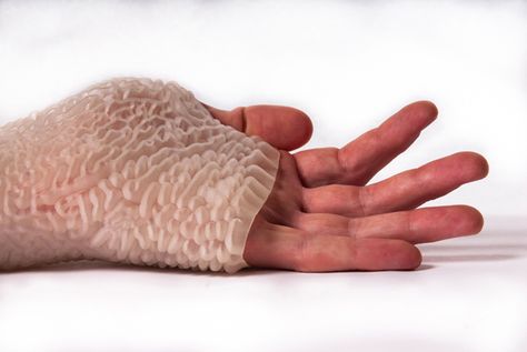 Urban Lab Global Cities (ULGC): Carpal Skin by Neri Oxman Neri Oxman, Median Nerve, Muscle Atrophy, Architectural Competition, Global City, Digital Fabrication, Landscape And Urbanism, Architecture Magazines, Carpal Tunnel