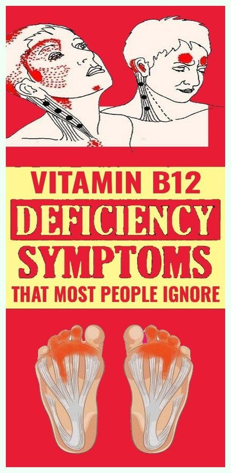 5 Warning Signs of Vitamin B12 Deficiency You Should Never Ignore Vitamin D Deficiency Symptoms, B12 Deficiency Symptoms, B12 Deficiency, Vitamin B12 Deficiency, Vitamin D Supplement, Vitamin D Deficiency, Nutrition And Dietetics, Simple Graphic, Graphic Design Software