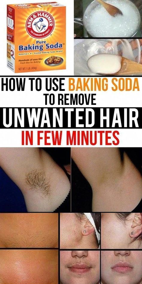 Unwanted Hair Removal Methods You Can Try at Home #HomeRemediesforUnwantedHair #UnwantedHairRemovalWithLaser #ChinHairRemoval #LegHairRemoval Male Hair Removal, Unwanted Facial Hair Removal, Best Permanent Hair Removal, Permanent Hair Removal Cream, Chin Hair Removal, Permanent Facial Hair Removal, Upper Lip Hair Removal, Back Hair Removal, Female Facial Hair