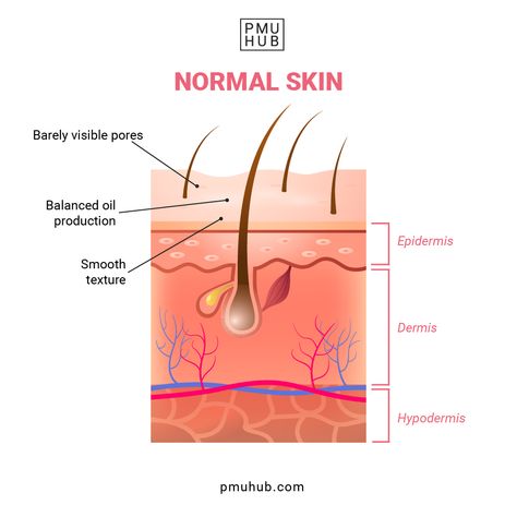 normal skin, how to determine your skin type, skin types Layers Illustration, Combination Skin Routine, Skin Anatomy, Forehead Acne, Oily T Zone, Skin Layers, Normal Skin Type, Skin Burns, Natural Acne Remedies