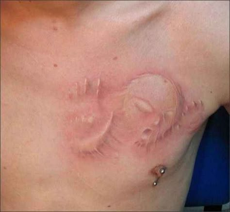 Don’t you hate it when you get an alien stuck beneath your skin? Amazing 3d Tattoos, Optical Illusion Tattoo, White Ink Tattoo, Alien Tattoo, Creepy Tattoos, Geniale Tattoos, 3d Tattoos, 3d Tattoo, Nerdy Things