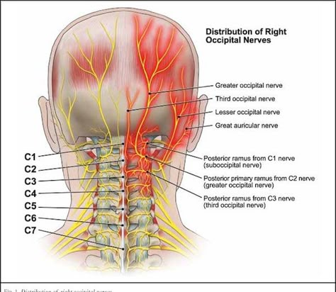 Occipital Nerve Block, Punkty Spustowe, Nerve Anatomy, Occipital Neuralgia, Chiari Malformation, Head Pain, Chronic Migraines, Headache Relief, Migraine Headaches