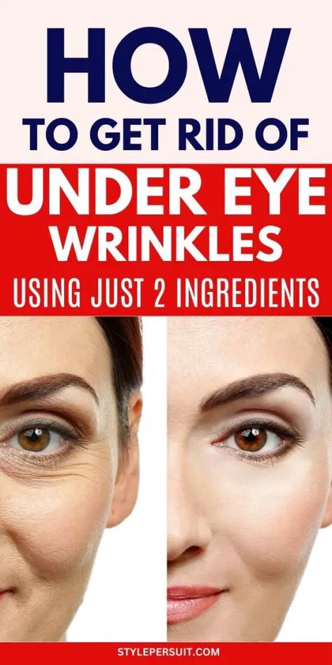 UNDER EYE WRINKLES REMEDIES Wrinkles Under Eyes Remedies, Wrinkle Under Eyes Remedies, Eyes Wrinkles Remedies, Wrinkles Under Eyes Get Rid Of, How To Remove Wrinkles On Face, Wrinkles Around The Eyes, How To Remove Eye Wrinkles, Under Eye Care Routine, Under Eye Wrinkles Makeup