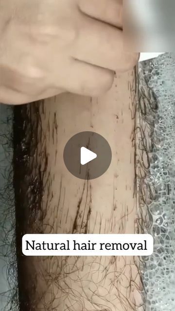 Health Beauty Treat on Instagram: "In 5 Minutes, Remove Unwanted Hair Permanently, No Shave No Wax, Painlessly Remove Unwanted Hair Easily at home 

#unwantedhair #hairremoval #hairtips #removehair #cleanhair #hairremove #beautyhacks #viralreels #reelindia #reelstrending #explore #instagramreels" How To Remove Body Hair Naturally, Home Made Wax, Diy Hair Removal, Unwanted Hair Permanently, Hair Removal Diy, Natural Hair Removal, Remove Unwanted Hair, Permanent Hair Removal, Painless Hair Removal