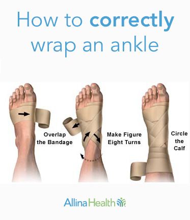 In this picture, we demonstrate three steps on how to correctly wrap an ankle with pictures. First Aid Tips, Diy Centerpiece, Survival Life Hacks, Trening Fitness, Sprained Ankle, Survival Life, Medical Knowledge, 웃긴 사진, Sports Medicine