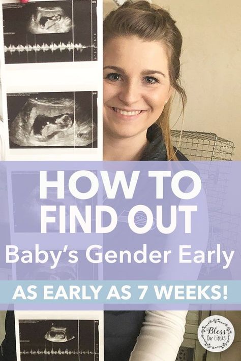 Knowing whether you are having a boy and girl can be exciting. If you are as impatient as I am... you HAVE to try this at home Gender Detection Test to know baby gender early! #GenderTest #FindOutBabyGender #GenderDNATest Ramsey Theory Baby Gender, Gender Test At Home, Ring Test Gender Prediction, Girl Or Boy Predictions, Boy Or Girl Prediction Signs, Ultrasound Boy Or Girl, 7 Weeks Pregnant Ultrasound, At Home Gender Test, Early Gender Prediction