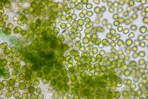 Chlorella under the microscope in Lab. Education of chlorella under the microsco , #Affiliate, #microscope, #Chlorella, #Lab, #chlorella, #Education #ad Microscopic Cells, Vitamin B12 Injections, Cell Forms, Negative Space Design, Dna Molecule, Aquarium Air Pump, Microscopic Images, Acrylic Tube, Soy Products