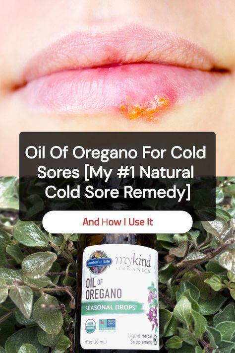 Save this pin to learn how I use oil of oregano for cold sores. If you’re looking for a natural cold sore remedy that packs a punch, this might become one of your favorites, too. Natural Remedies For Cold Sores, Essential Oil For Cold Sore On Lip, Diy Cold Sore Remedy Fast, Home Remedies For Cold Sores, Cold Sore Remedy Fast, Heal Cold Sores Fast, Cold Sore Remedy Overnight, Cold Sore Essential Oil, Essential Oil Blends For Colds