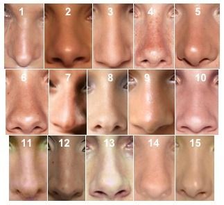 Different nose shapes, can be used as a reference in drawing a face. Nose References, Types Of Nose, Nose Reference, Different Nose Shapes, Nose Types, Face Anatomy, 얼굴 드로잉, Nose Drawing, Nose Shapes