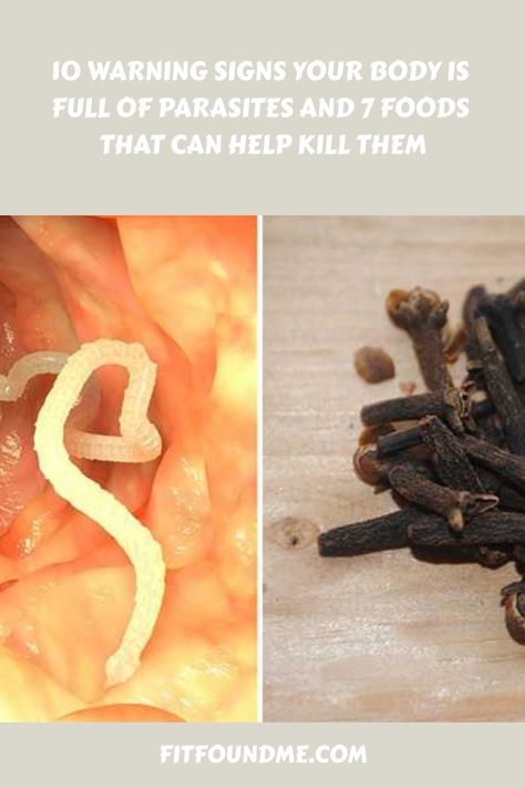 I don’t want to freak you out, but chances are YOU HAVE PARASITES. Yep, it’s true; about one third of Americans have parasites living in their digestive system. Are you shocked?! While this may surprise you, parasites are more common than you may realize. There are countless kinds of parasites that exist and many of … How To Cleanse Your Body Of Parasites, What Kills Parasites, Nematodes Parasites, Anti Parasitic Foods, How To Get Rid Of Parasites, Foods That Kill Parasites, Parasite Pictures, Parasites Symptoms, Skin Parasites