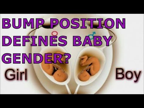 Baby gender prediction with baby bump || Boy or girl || Do girl and boy bumps look differentBaby gender prediction with baby bump || Boy or girl || Do girl and boy bumps look different Sign of baby boy or girl during pregnancy. #babybump ... Boy Or Girl Prediction, Baby Boy Signs, Baby Gender Prediction, Belly Boy, Gender Prediction, Belly Bump, Different Signs, Pregnant Belly, Unique Names