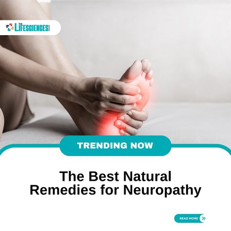 Discover the power of nature in relieving neuropathy! Explore the best natural remedies to ease discomfort and promote nerve health. Your guide to a holistic approach for a better quality of life. Nerve Repair, Nerve Pain Remedies, Muscle Twitching, Nerve Health, Itching Skin, Poor Circulation, Nerve Pain Relief, Improve Circulation, Nerve Pain