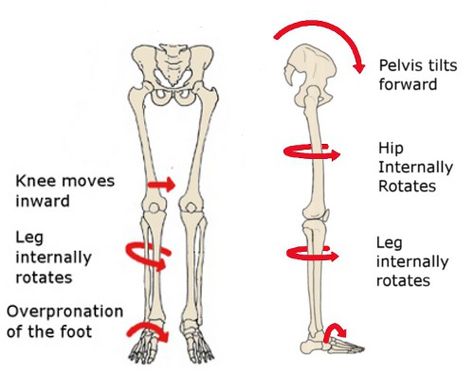 4 causes of knee pain that have nothing to do with the knee | jessephysio Flat Feet Exercises, Patellofemoral Pain Syndrome, Psoas Release, Knock Knees, Hip Problems, Foot Exercises, Running Injuries, Pelvic Tilt, Hip Flexor Stretch