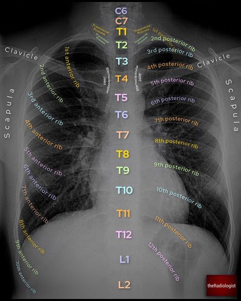 Radiology Technician Aesthetic, Radiography Student Aesthetic, Radiology Student Aesthetic, Radiography Student, Radiology Schools, Medical Assistant Student, Radiology Student, Radiology Technician, Radiology Imaging