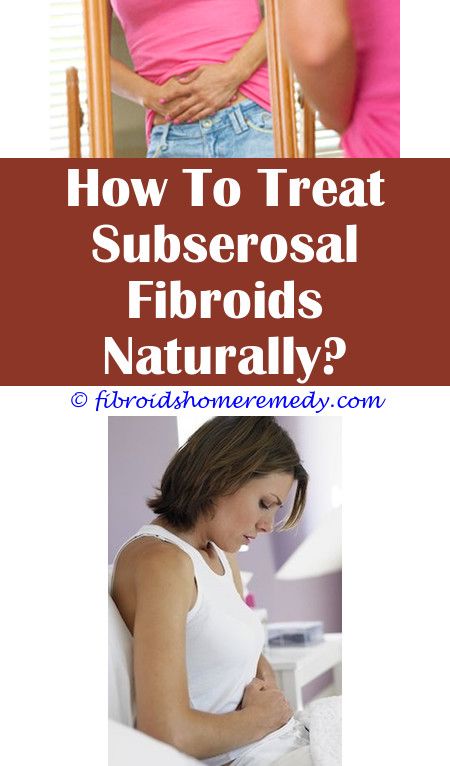 Fibroids Weight Loss