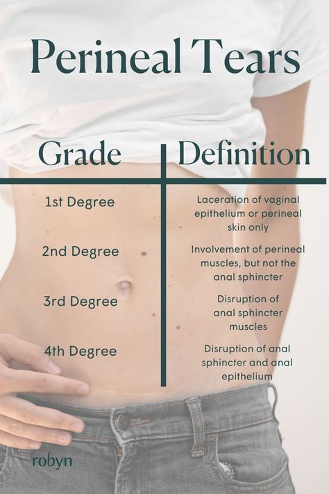 A grade 1 or grade 2 tear usually heals well. Grade 3 and 4 tears are larger, and may take longer to heal. These tears can result in pain, soreness, urination or fecal incontinence. However a grade 1 or 2 tear can also be painful. For more on postpartum recovery and the changes your body goes through, read the full article by Doctors of Physical Therapy @solsticephysicaltherapy Perineal Tear, Doctor Of Physical Therapy, Postpartum Care, Postpartum Recovery, Grade 3, Grade 2, Physical Therapy, New Parents, Postpartum