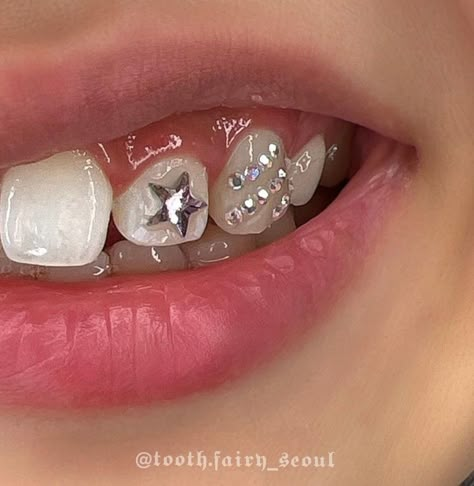 Smiley Piercing Aesthetic, Teeth Jewels, Tooth Gem Ideas, Teeth Gems, Pretty Teeth, Dental Jewelry, Grillz Teeth, Diamond Teeth, Grills Teeth