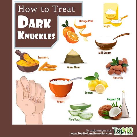 How to Treat Dark Knuckles | Top 10 Home Remedies Dark Knuckles Remedies, Best Skin Lightening Cream, Dark Knuckles, Oily Skin Face, Skincare Diy, Organic Skin Care Routine, Top 10 Home Remedies, Diy Coconut Oil, Coconut Oil For Face