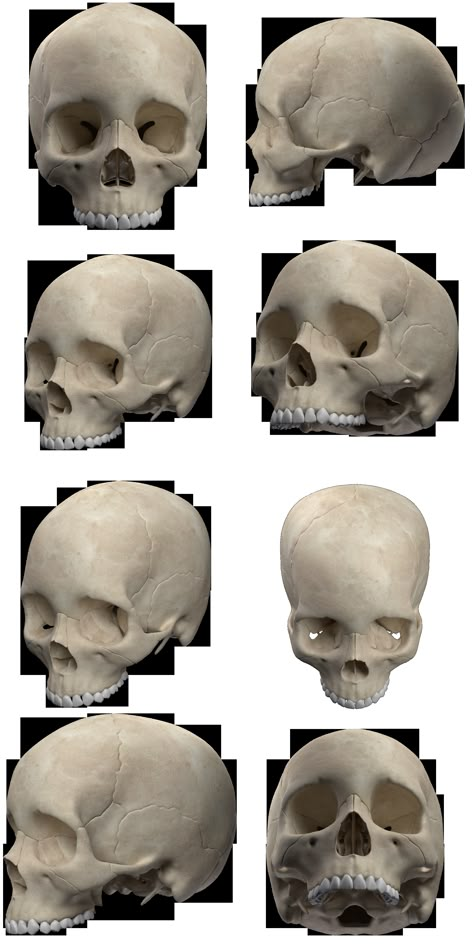 Skull without jaw Stock by NiosDark on DeviantArt Skull Anatomy, Skull Reference, Skeleton Anatomy, Characters Inspiration, Human Anatomy Art, Anatomy For Artists, Skull Drawing, Human Skull, Arte Inspo