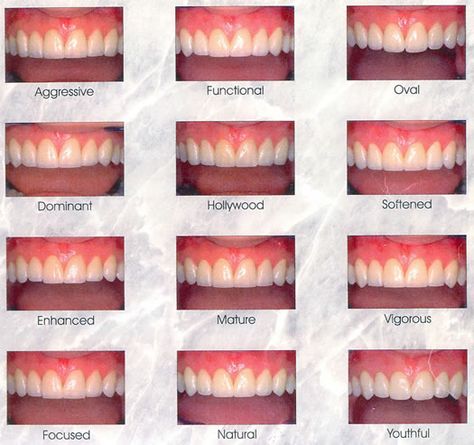 K9 Teeth Human Aesthetic, K9 Teeth Human, Types Of Teeth Shapes, The Braces Guy, Braces Guy, Teeth Inspiration, Different Types Of Teeth, Digital Smile Design, Shiny Teeth