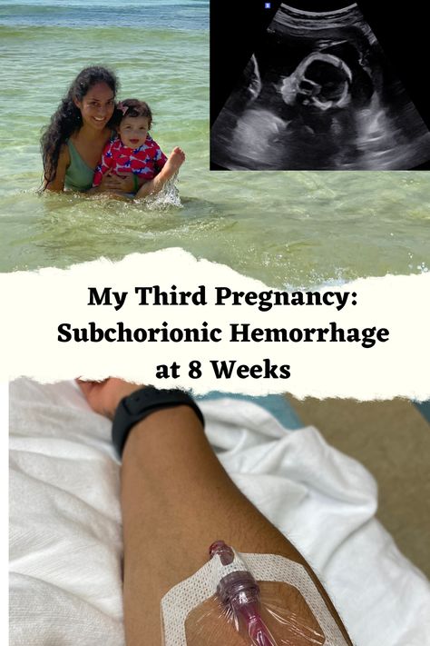 My Third Pregnancy: Subchorionic Hemorrhage at 8 Weeks (First trimester symptoms) – Mama West Subchorionic Hemorrhage, 8 Weeks Pregnant, 8 Weeks, Pregnancy Help, 1st Trimester, Third Pregnancy, First Blood, Second Trimester, Morning Sickness