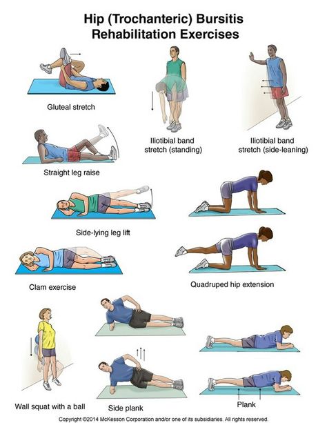 Bursitis Hip Pain Diagnosis Chart