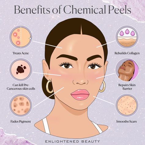 Benefits of Chemical Peels — Enlightened Beauty by Morgan Elizabeth Chemical Peel Marketing, Benefits Of Chemical Peels, Face Treatments Skincare, Peel Season Esthetician, Chemical Peel Aesthetic, Esthetics Tips, Chemical Peel Before And After, Chemical Peel Benefits, Peel Season