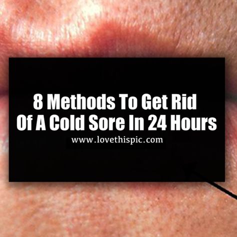 8 Methods To Get Rid Of A Cold Sore In 24 Hours How To Get Rid Of Cold Sores, Cold Sore Remedy Quick Overnight, Cold Sore Remedy Overnight, Stages Of A Cold, Cold Sore Stages, Cold Sore Remedy, Natural Cold Sore Remedy, Swelling Remedies, Cold Sore Relief