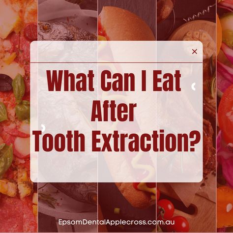 Worried about tooth extraction? The procedure is typically less daunting than anticipated, and most individuals experience a quick recovery. However, you may have concerns about your diet after wisdom teeth removal. Following a nutritious diet can help minimise swelling, lower the risk of complications, provide essential nourishment, and support the healing process of the wound. Call (08) 9316 0555 or visit us at 729 Canning Highway in Applecross. Post Wisdom Teeth Food, Wisdom Teeth Recovery Food, Eating After Tooth Extraction, Wisdom Teeth Food, Wisdom Teeth Recovery, Soft Foods To Eat, After Wisdom Teeth Removal, Tooth Extraction Aftercare, Tooth Extraction Healing