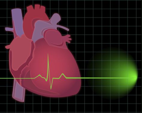 Increase your heart smarts with info on how exercise impacts your heart, how to measure fitness via heart rate, and top cardio concerns fitness pros should know. How it Works Your heart weighs only about 10 ounces and is roughly the size of an adult fist. This four chamber, centrally located pump pushes How To Perform Cpr, Enlarged Heart, Reducing Blood Pressure, Ear Candling, Heart Valves, Parts Of The Heart, Heart Pump, Increase Heart Rate, Leg Massage