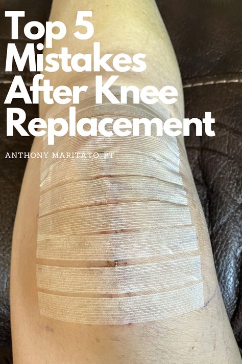 1 week post op total knee replacement Post Op Knee Replacement Exercises, Exercise After Knee Replacement, Preparing For Knee Replacement Surgery, Exercises After Knee Replacement Surgery, Knee Replacement Recovery Gifts, Knee Replacement Recovery Tips, Full Knee Replacement, Knee Replacement Pain, Hyperextended Knee