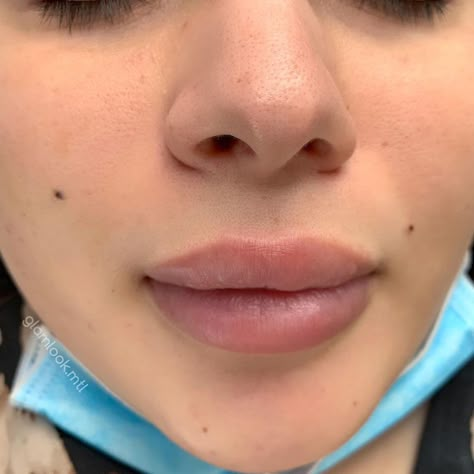 Cute Face Moles, Beauty Moles On Face, Beauty Spot Tattoo Face, Cute Moles On Face Aesthetic, Face Moles Beauty Marks Aesthetic, Beauty Moles Aesthetic, Face Mole Tattoo Beauty Marks, Mole Above Lip Beauty Marks, Women With Moles On Face