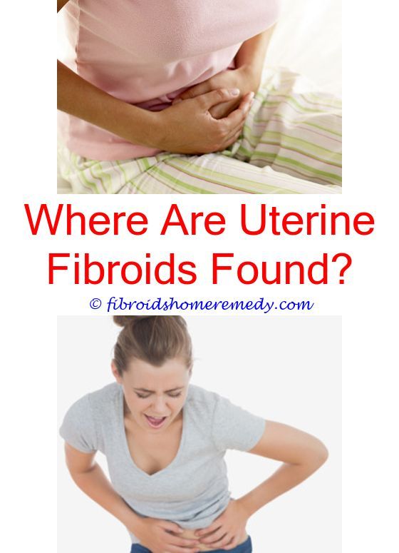 Uterine Fibroid Pain Pelvic Rehabilitation Medicine