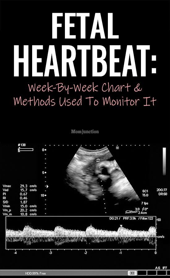 Fetal Heartbeat Week By Week Chart And Methods Used To Monitor It | My ...