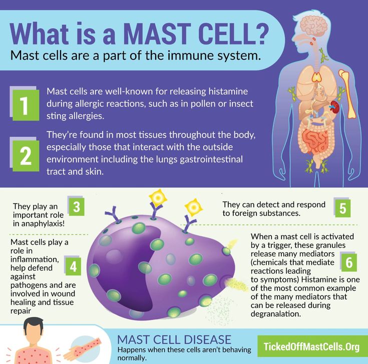 “What is Mast Cell Activation Syndrome?” (article, infographics, resources) #TickedOffMastCells High Histamine Foods, Mast Cell Activation, Dysautonomia Pots, Autoimmune Disorders, Histamine Intolerance, Immune Cells, Chest Discomfort, Mast Cell Activation Syndrome, Low Histamine Diet