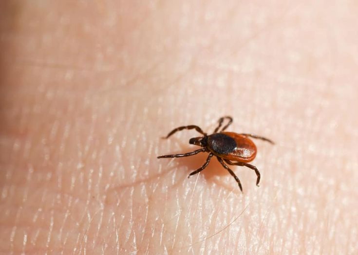 14++ How to remove a tick head from human skin information | usefulzone7