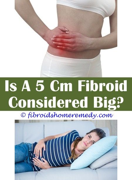 What Is Fibroid Embolization | Fibroid cyst, Uterine fibroids, Fibroid ...