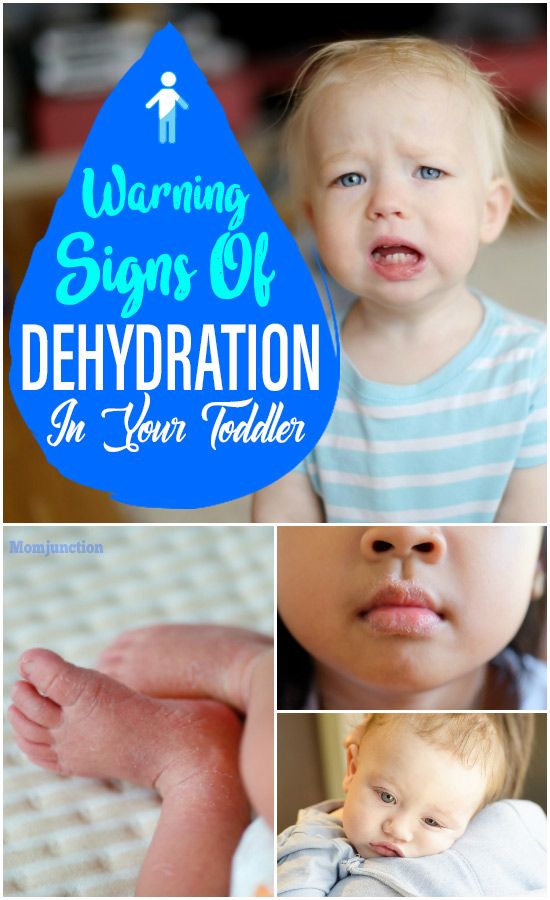 a collage of photos with the words warning signs of dehydraation in your toddler