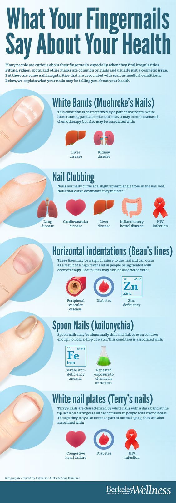 Medical infographic : What Your Fingernails Say About Your Health Clubbing Nails, Fingernail Health, Tongue Health, Avocado Smoothie, Easy Nails, Mental Training, Nail Health, Health Facts, Health Info