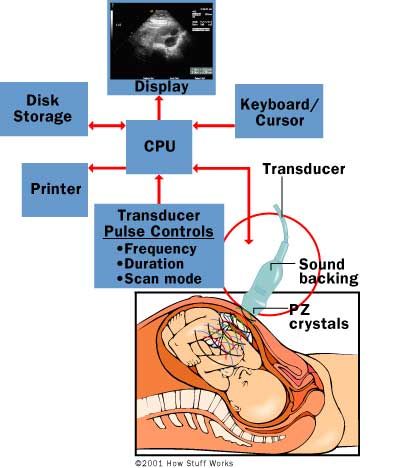 How Ultrasound Works- Pictured: The parts of an ultrasound machine Ultrasound Physics, Vascular Ultrasound, Radiologic Technology, Ultrasound Sonography, Medical Images, Medical Sonography, Diagnostic Medical Sonography, Ultrasound Machine, Ultrasound Technician