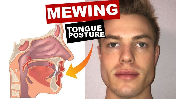 MEWING Tongue Posture | Train Your Tongue to Attach to Your Mouth - YouTube Mewing Tongue Posture, Tongue Posture, Jaw Exercises, Jawline Exercise, Facial Exercise, Myofunctional Therapy, Double Menton, Tongue Health, Face Exercises