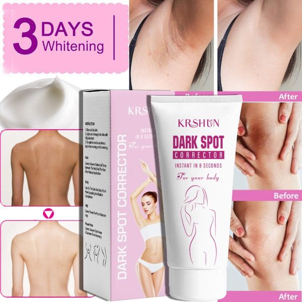 10g/2-g/30g/50g Face & Body Skin Whitening Cream Milk Whitening Cream Whole Body Lotion Neck Knee Leg Whitening Lotion Moisturizing Glass Skin Home Remedies, Best Whitening Lotion, Skin Home Remedies, Body Whitening Cream, Facial Routine Skincare, Whitening Cream For Face, Body Whitening, Skin Lightening Cream, Natural Face Skin Care