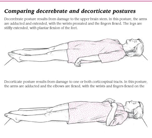 a poster describing how to use the correct posture